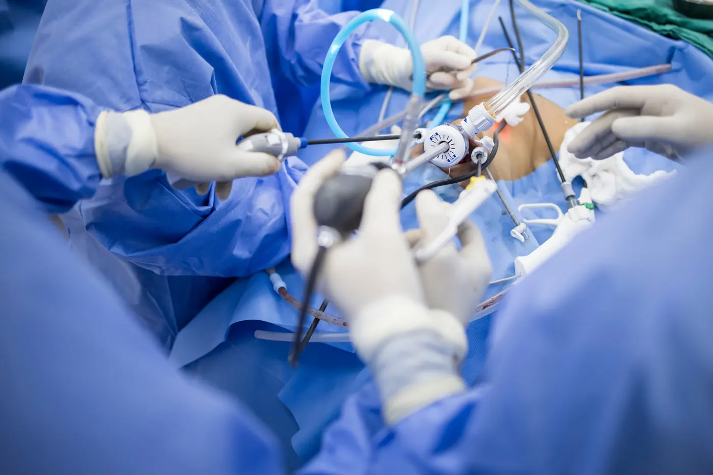 Procedimiento — Cirugía de hernia inguinal en Zapopan en Hospital Ángeles Andares