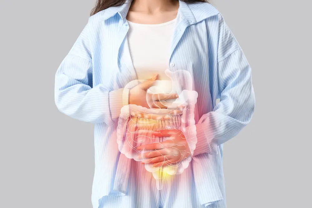 Especialista en colitis ulcerosa y enfermedad de Crohn en Zapopan