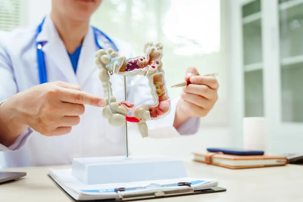 Procedimiento — Especialista en colon irritable en consulta en Zapopan
